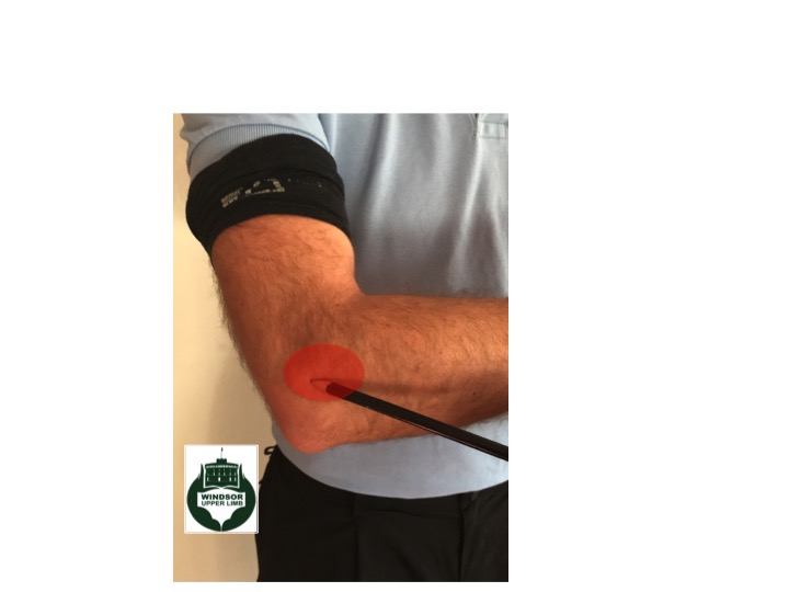 Tennis/Golfers elbow